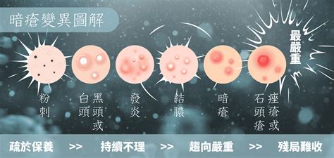 外陰石頭瘡|石頭瘡成因、症狀與治療